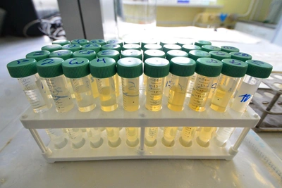 Россия ограничивает генетические данные: последствия для науки