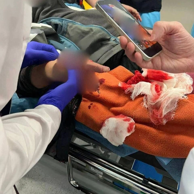 Школьнику сделали операцию | Источник: «Красногорск Сегодня» / Telegram