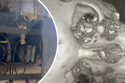 Подростку сломали глазницу в Одинцово после драки с толпой