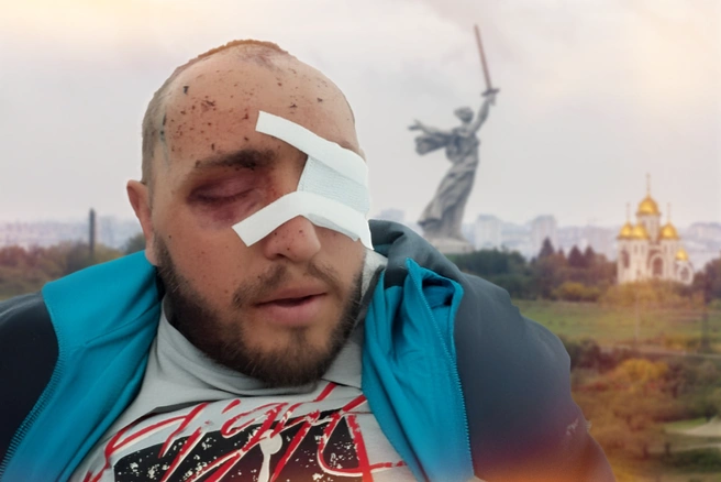 Павел Подгрушний потерял возможность видеть и нормально слышать | Источник: Мария Романова / Городские медиа