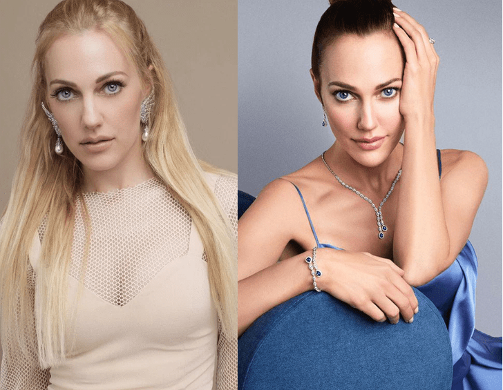 Как выглядят топовые турецкие актрисы до и после пластики