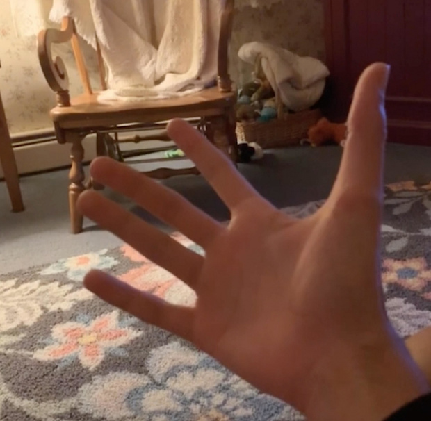 Аномально длинный большой палец сделал студента из США героем Сети