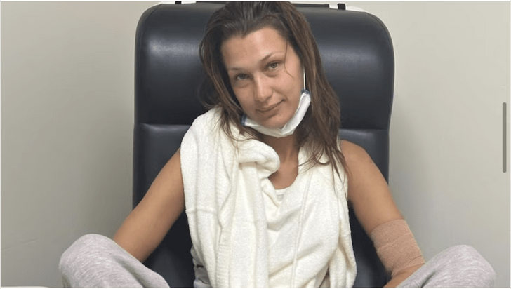 Белла Хадид 100 дней лечилась от болезни Лайма: детали и комментарии врачей