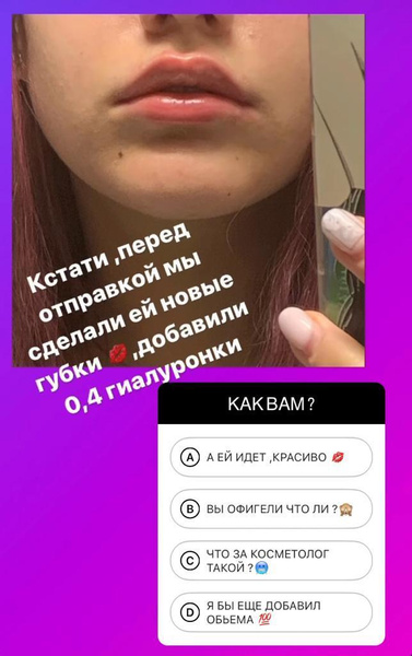 15-летняя дочь Борисовой увеличила губы, Дмитренко говорит нежности Самониной на свидании. Соцсети звезд
