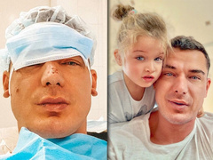 3-летняя дочь так травмировала лицо Курбану Омарову, что ему пришлось отправиться в больницу