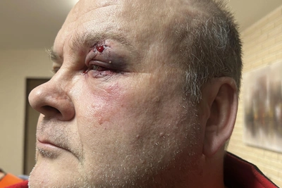 В Челябинске водитель избил пешехода и скрылся