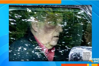 Эндрю Уиндзор в центре слухов из-за большого синяка на лице