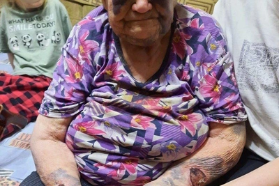 СК взял на контроль дело о смерти избитой бабушки