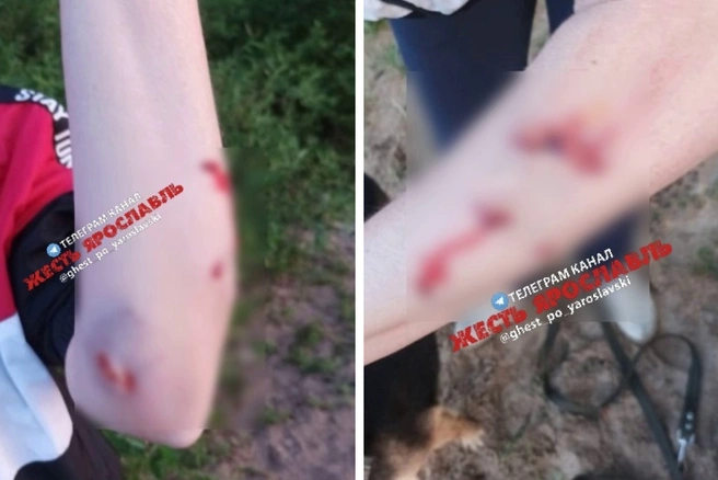 В Ярославле женщина пострадала от нападения собаки | Источник: Жесть Ярославль / Vk.com