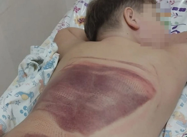 Прокуратура проводит проверку после ЧП с мальчиком в «Окской жемчужине» | ya62.ru