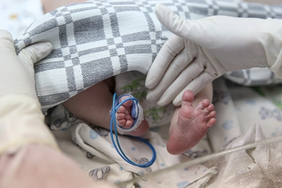 Тюменские врачи прооперировали более 20 детей с аномалиями пальцев