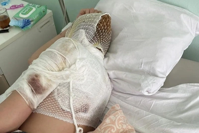 «Я мысленно попрощалась»: сосед поджег девушку в Екатеринбурге