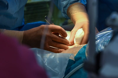 Опухоль размером с лимон удалили у ставропольца в Пятигорске