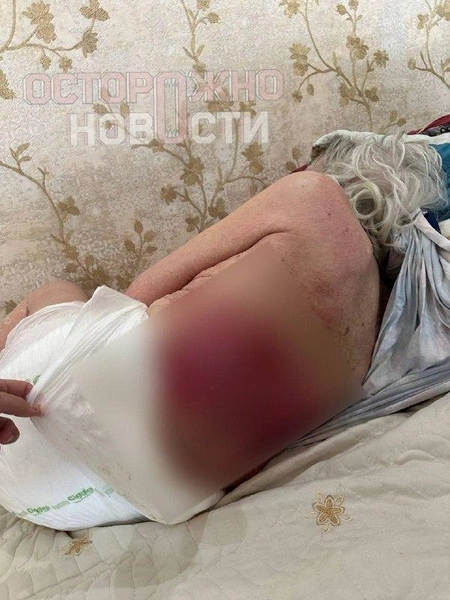 Внучка застала бабушку в ужасном состоянии