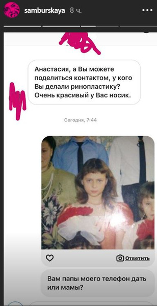 Настасья Самбурская рассказала о своих пластических операциях