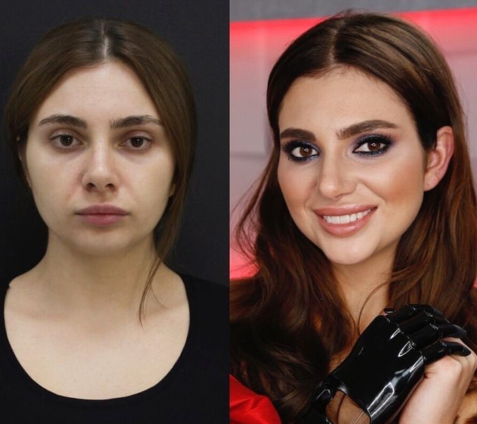 Бьюти-преображение: фото девушек до и после «Перезагрузки»