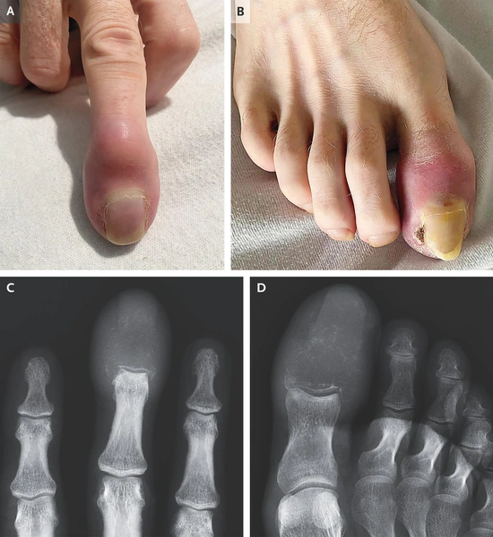 Источник: The New England Journal of Medicine