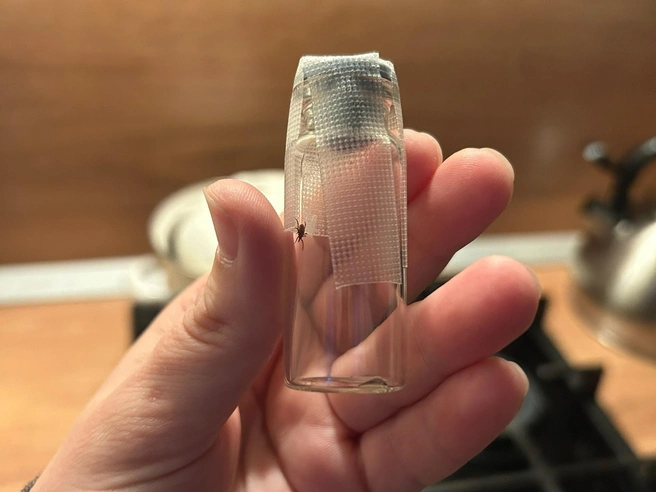 Присосавшегося клеща сняли с тела живым | Источник: Мария Овчинникова