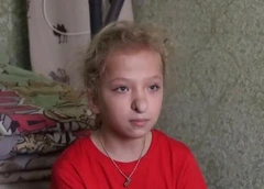 «Меня никто не будет обзывать Бабой-ягой»: 10-летняя Варя стесняется своего носа и просит об операции, но мама против