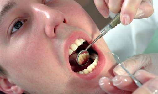 8 литров колы ежедневно навсегда избавили от визитов к стоматологу