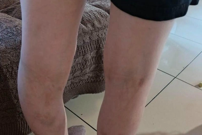 Tyumen Women Accuse Guardians of Child Abuse in Shelter