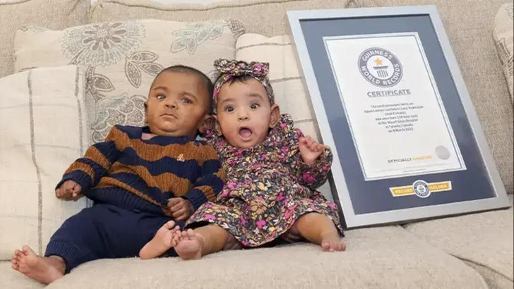 «Ноль шансов на выживание», — канадские брат и сестра родились самыми недоношенными близнецами в мире