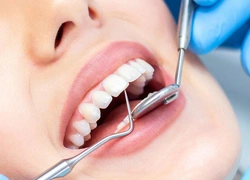 В Казахстане пенсионные на лечение зубов планируют перечислять после оказания услуги