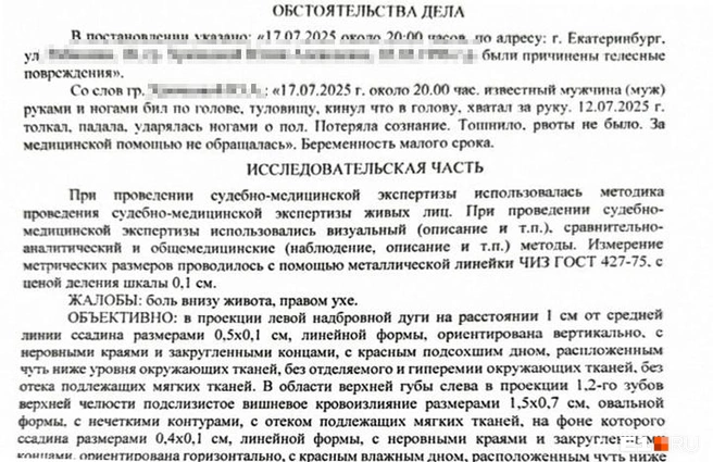 Экспертиза зафиксировала повреждения, которые не повлекли вреда для здоровья | Источник: читатель E1.RU