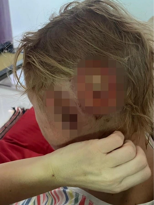 Страшные раны на голове | Источник: Светлана Шерстобоева