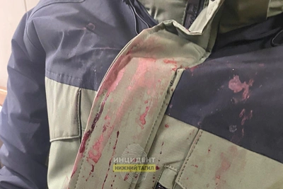 Кикбоксер жестоко избил школьника в Нижнем Тагиле