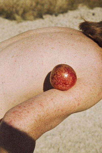Боль в правом плече и еще 5 неочевидных признаков рака печени