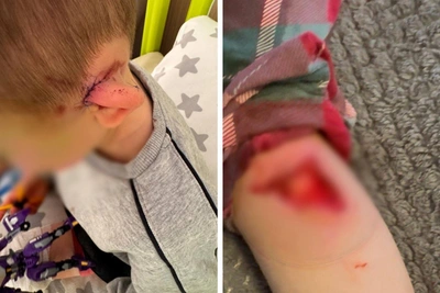 Four-year-old miraculously saved after dog attack in Moscow region