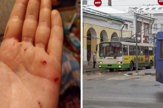 Пассажирка потеряла сознание, взявшись за поручень | Источник: предоставлено пострадавшей, Александра Мамонтова
