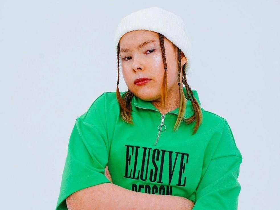 Вдохновляющая история крутой девочки Алисы, которая превратила ихтиоз в свою фишку | Источник: Анна Топорищева