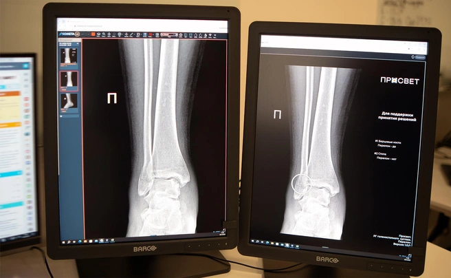 Источник: Департамент здравоохранения Москвы