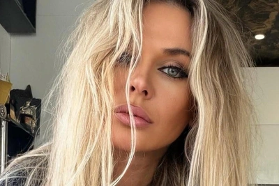 «Это катастрофа»: Таня Терешина в ужасе от результата бьюти-процедуры