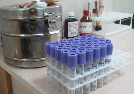 Медцентр выдал справку о полном здоровье рязанцу с ВИЧ | ya62.ru