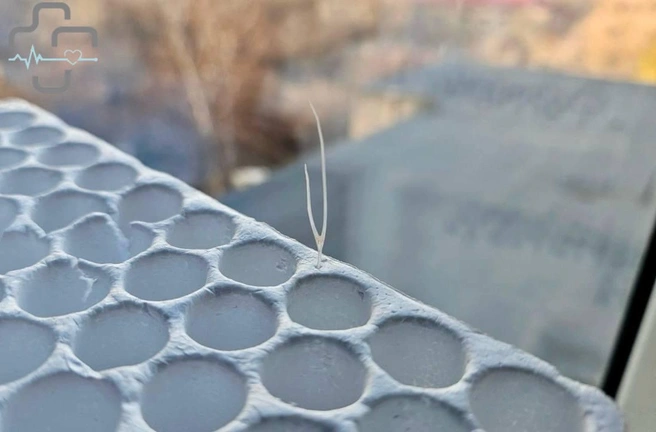 Та самая кость | Источник: ГАУЗ «ГБ» Орска