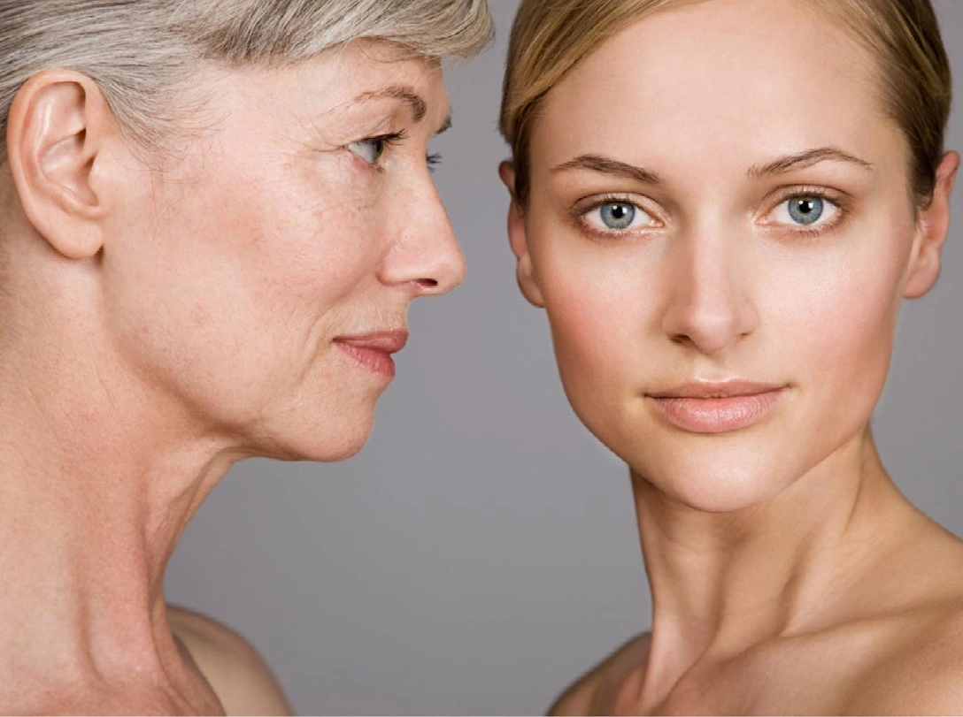 Птоз: почему лицо «обвисает» и как с этим бороться | marieclaire.ru