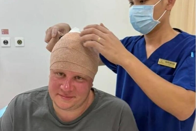 Евгений Кулик травмировал голову во Вьетнаме