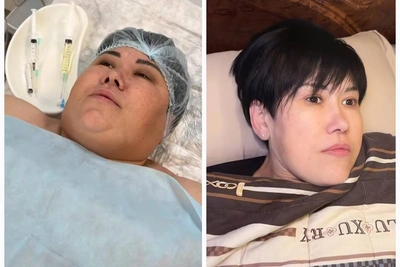 Bashkir Blogger Loses 60 kg, Shares Before-and-After Photos