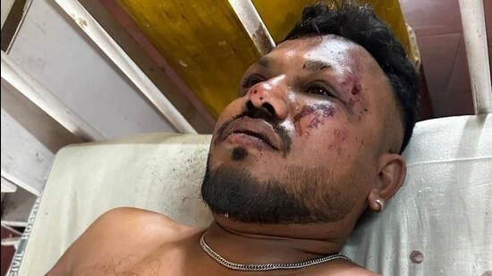 Выживший получил травмы груди, глаз и ног — но ни одна из травм не является тяжелой | Источник: HT Photo