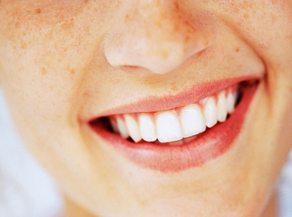 Все, что стоит знать об отбеливании зубов | marieclaire.ru