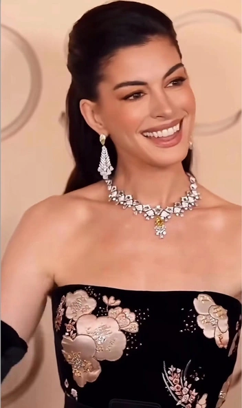 Энн Хэтэуэй заподозрили в пластике лица  | Источник: annehathaway / Instagram (экстремистская организация, деятельность запрещена на территории РФ)