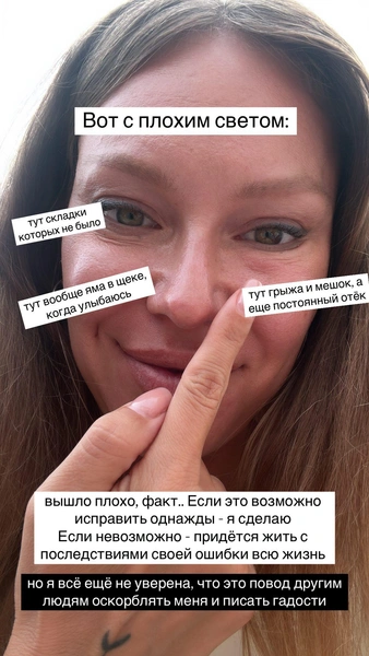 Дакота никогда не была довольна своей внешностью