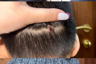 В Якутске 8-летний мальчик напал на сверстника с ножом