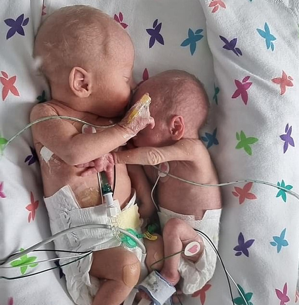 До слез: близнецы, разлученные при рождении, снова обнимают друг друга