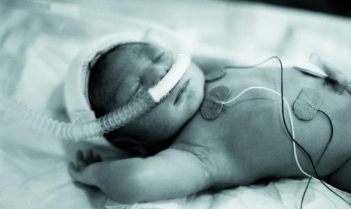В 2014 году у 1257 новорожденных нашли тяжелые наследственные заболевания