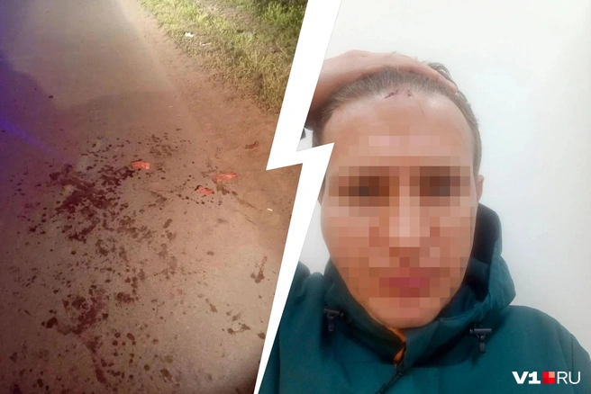 О ночном нападении рассказала супруга пострадавшего мужчины | Источник: читатели V1.RU