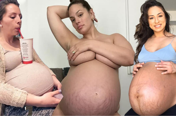 Самые неприглядные моменты беременности — 20 фото, которые вас поразят